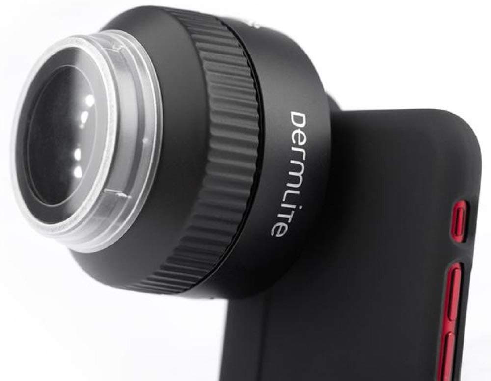 DermLite FOTO Digital Epiluminescence Microscopy System