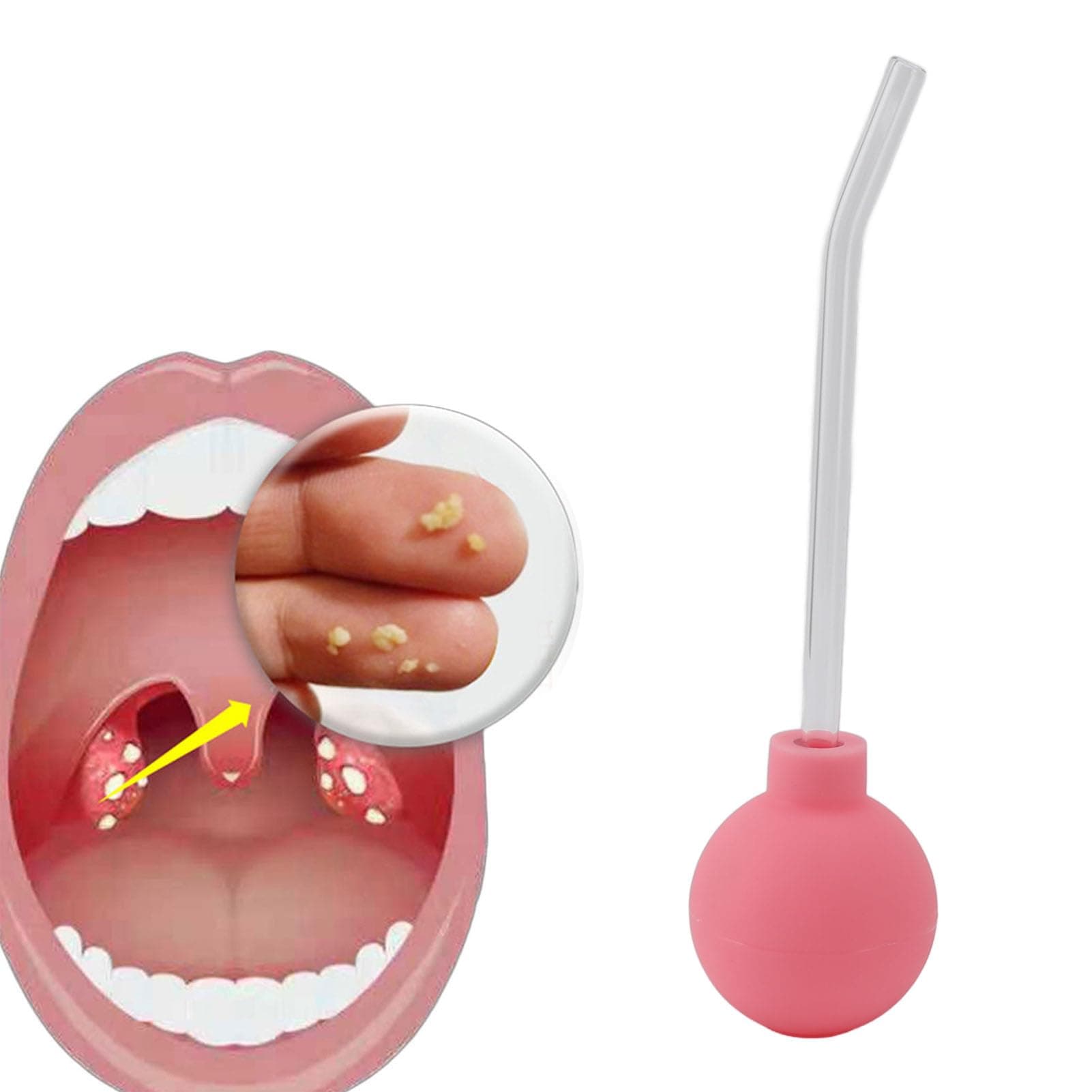 Tonsil Stone Remover, Tonsil Stone Remover Vacuum for Treating Bad Breath, Tonsil Stone Suction Device, Oral Odor Treatment for Adults, Throat (Pink)