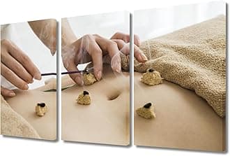 Moxa Moxibustion Prints for Wall Decor Moxibustion Framed Wall Art Posters & Prints 3 Panels Nosocomium Paintings Giclee Print Gallery Packaging Artwork (36" Wx24 H)