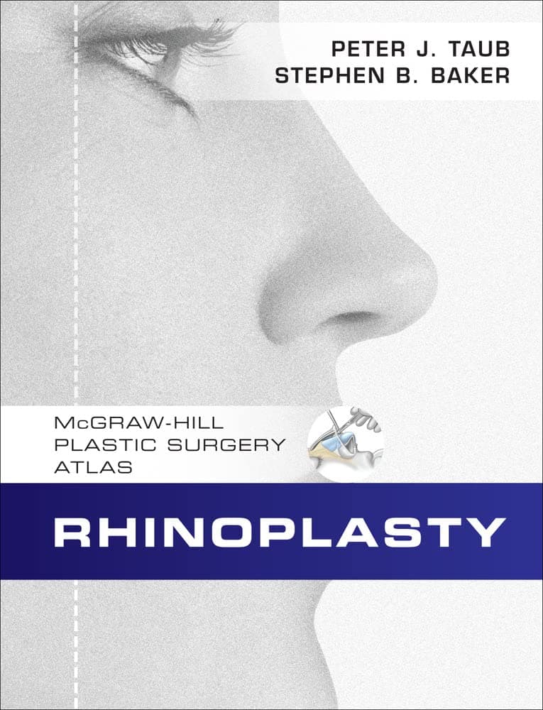 Rhinoplasty 1st Edition
