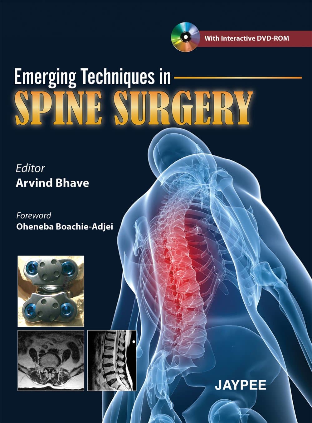 Emerging Techniques in Spine Surgery with Interactive DVD-ROM First Edition