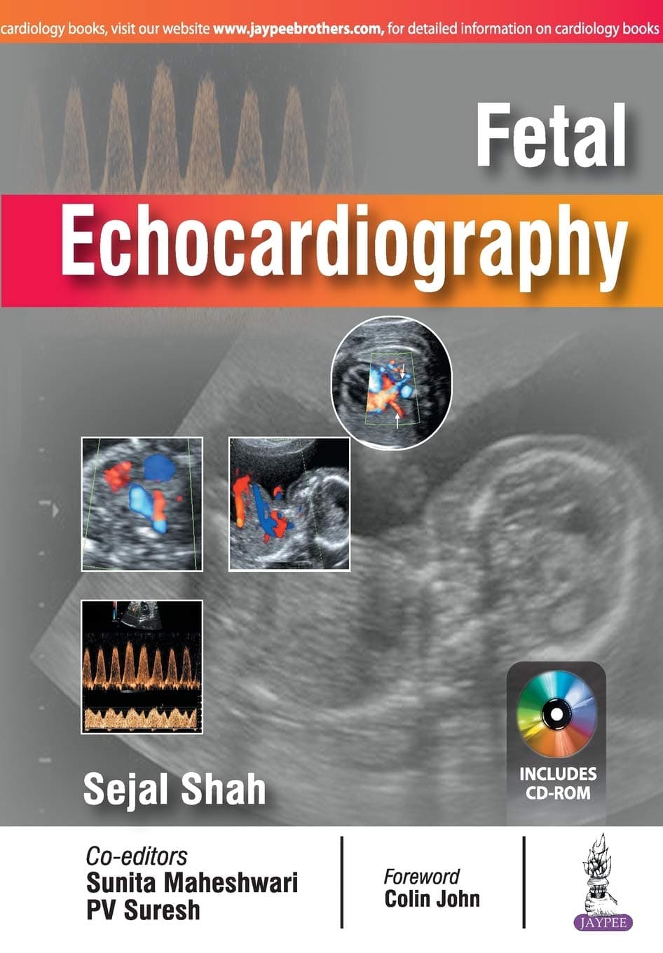 Fetal Echocardiography Paperback – 1 January 2017