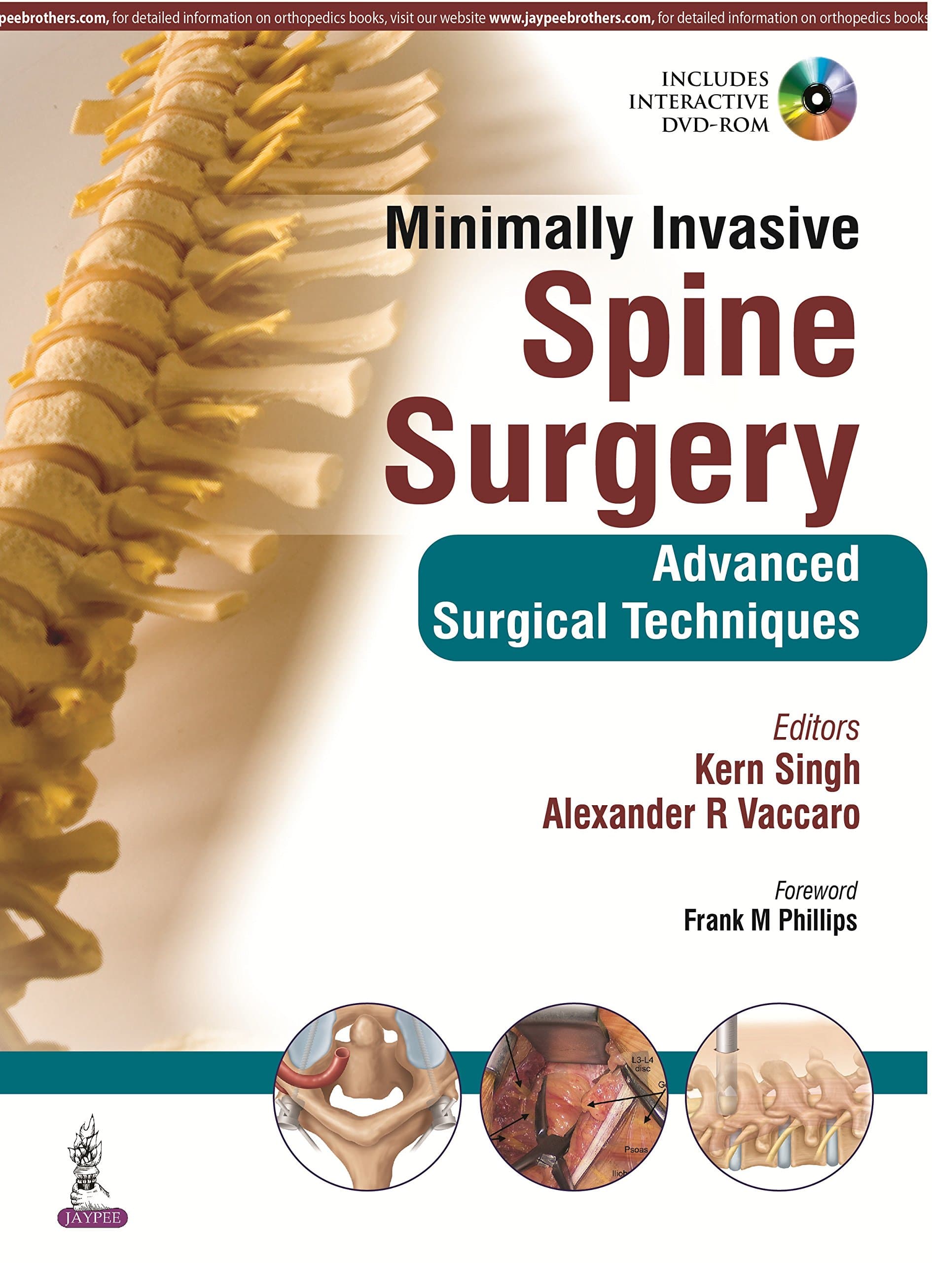 Minimally Invasive Spine Surgery: Advanced Surgical Techniques 1st Edition