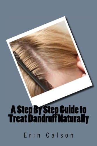A Step By Step Guide to Treat Dandruff Naturally